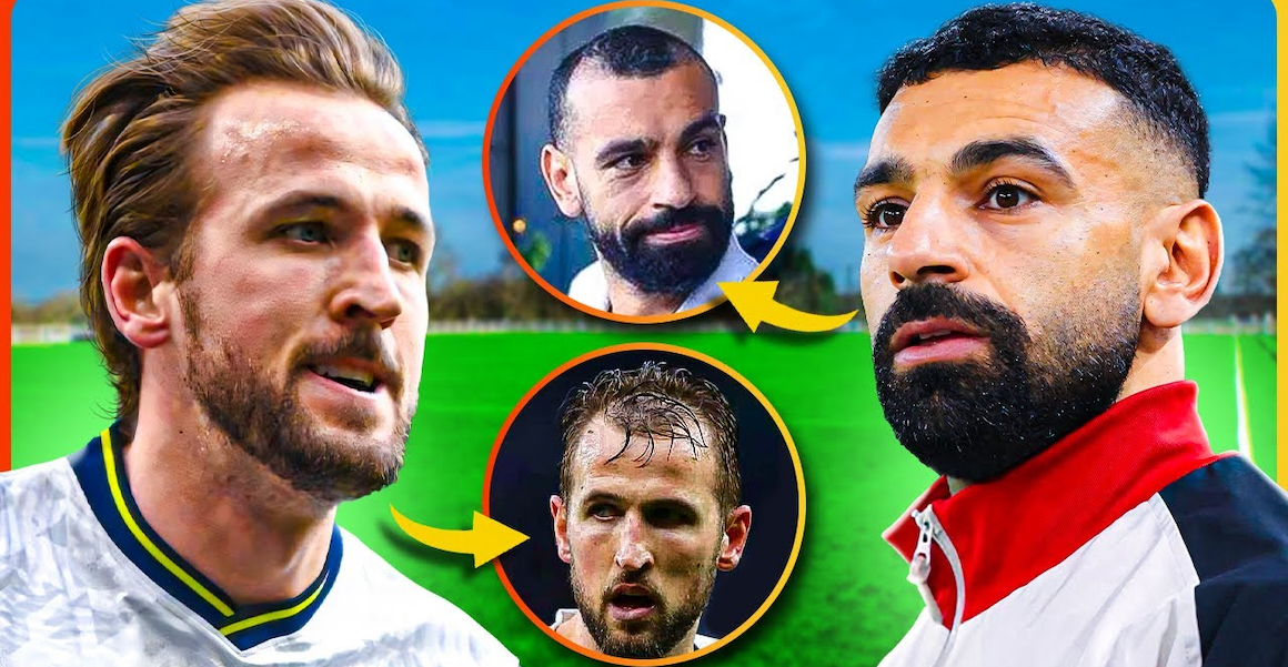 Die Top 10 Haartransplantationen von Fußballern: Vorher und Nachher